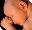 Abortion in Jewish Law 